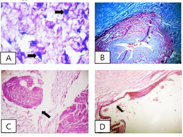 Histological indices of umbilical cord in healthy neonate and asphyxia neonate